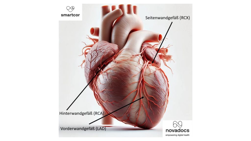 Abbildung menschliches Herz mit Herzkranzgefaessen
